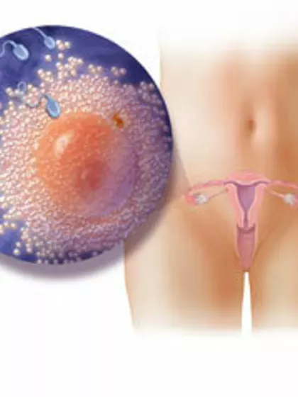 Alwsex – Sperm Donor in Meerut City, Uttar Pradesh, India