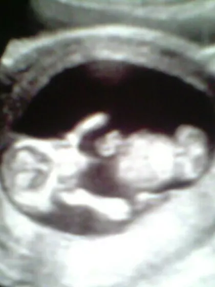 Steph – Surrogate Mother in Kidderminster, England, United Kingdom