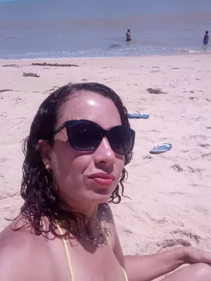 Caroline – Egg Donor in Campos dos Goitacazes, Rio de Janeiro, Brazil