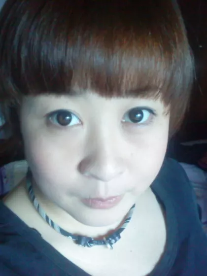 Xiaowei – Egg Donor in Hai tien, Beijing, China – photo 2