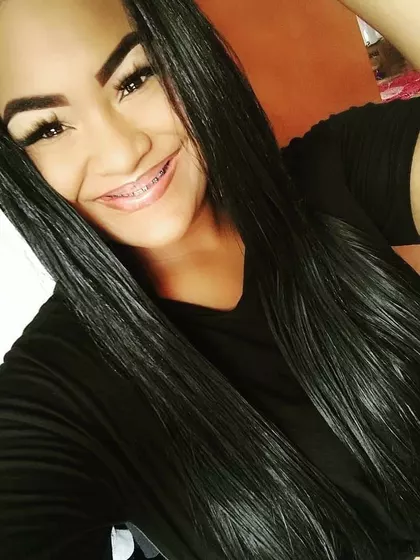 Ana – Egg Donor in Duque de Caxias, Rio de Janeiro, Brazil