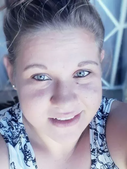 Nicolene – Egg Donor in Meer en See, KwaZulu Natal, South Africa