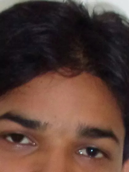 Photo 2 of sperm donor profile in Delhi, Delhi, India