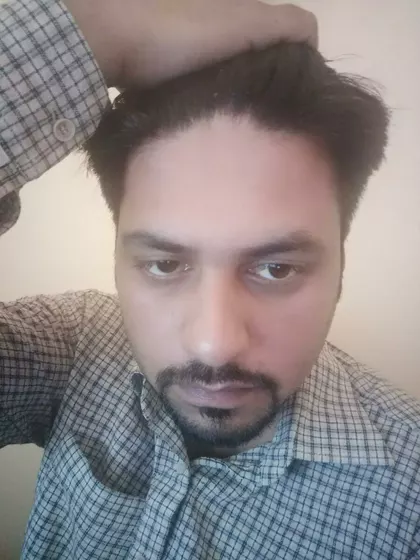 Fraz – Sperm Donor in Lahore, Punjab, Pakistan