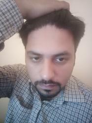 Fraz