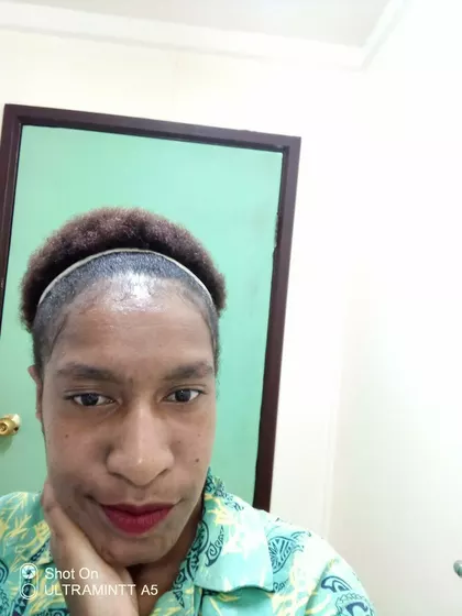 Effat – Egg Donor in Hagen, Western Highlands, Papua New Guinea