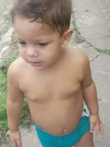 Monike – Surrogate Mother in Maceio, Alagoas, Brazil